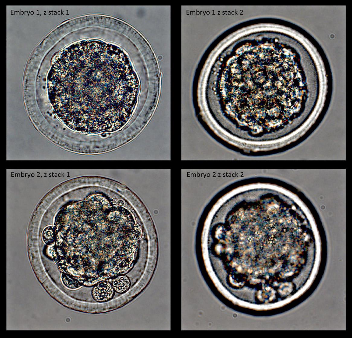 Embryos stack