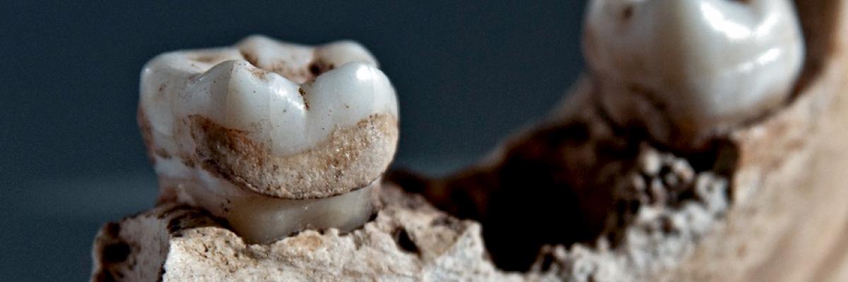 Ancient DNA teeth