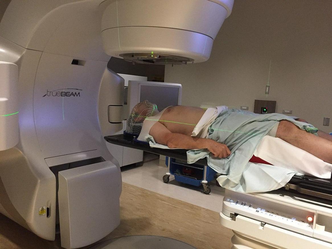 Radiotherapy