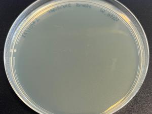 Person B: Bacteria that could grow after using hand sanitiser.