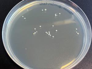 Person A: The amount of bacteria that could grow after using hand sanitiser.
