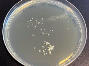 Person B: An agar plate with bacteria growing from unwashed hands.