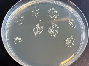 Person A: An agar plate with bacteria growing from unwashed hands.