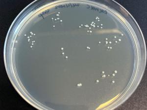 An agar plate showing bacteria from a hand washed with soap. Clearly something weird was happening here, likely contamination from the lab equipment!