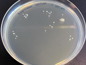 An agar plate showing the bacteria grown from an unwashed hand.