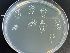 This agar plate shows the same contamination that was present for the soap results. 