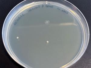A soap and sanitiser combination was effective at killing the bacteria on one person’s hands.