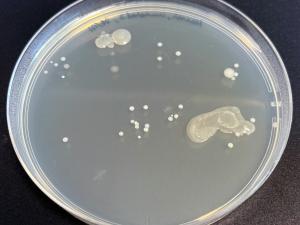 An agar plate showing the bacteria grown from an unwashed hand.