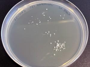 An agar plate showing the bacteria grown from an unwashed hand.