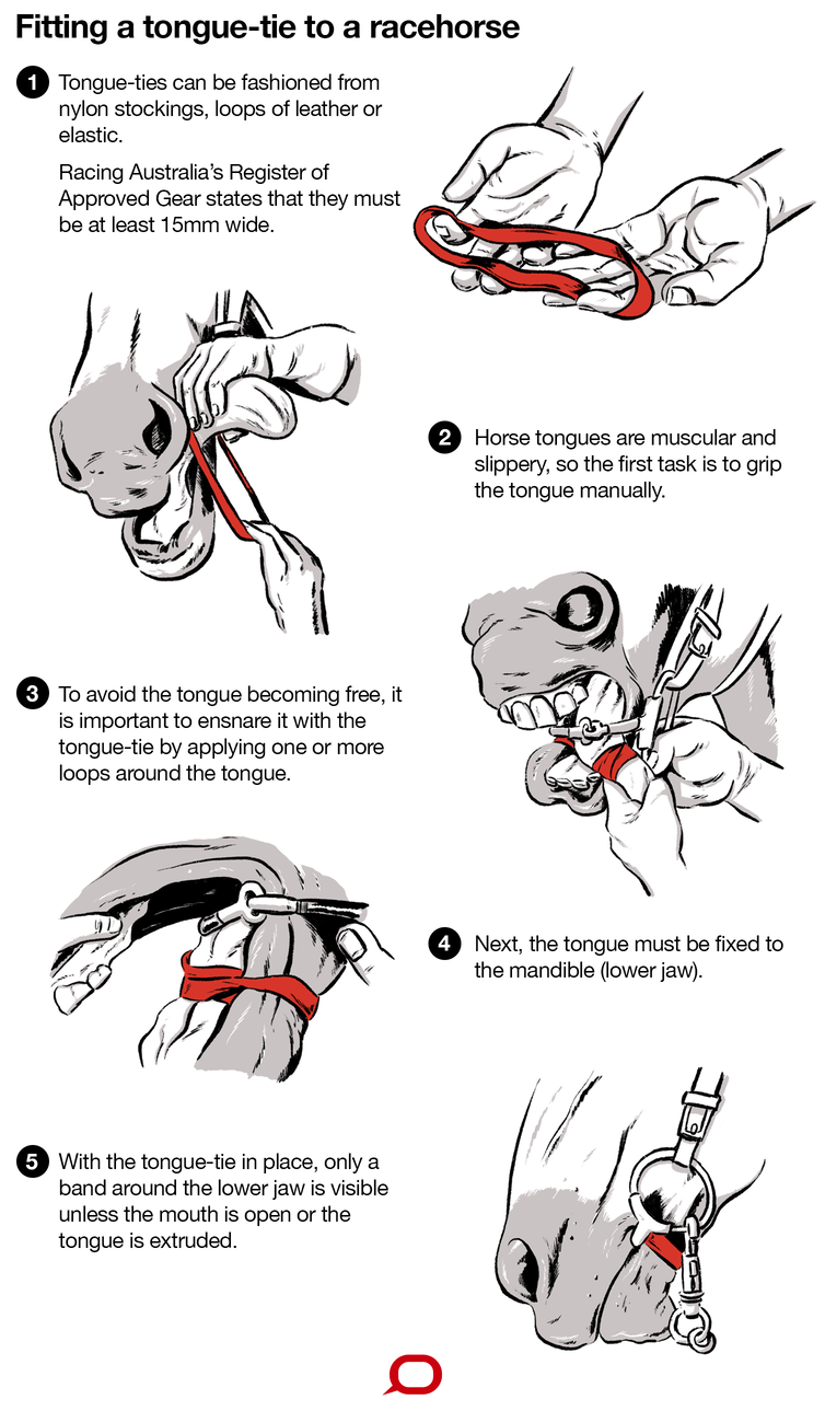 Tongue tie information
