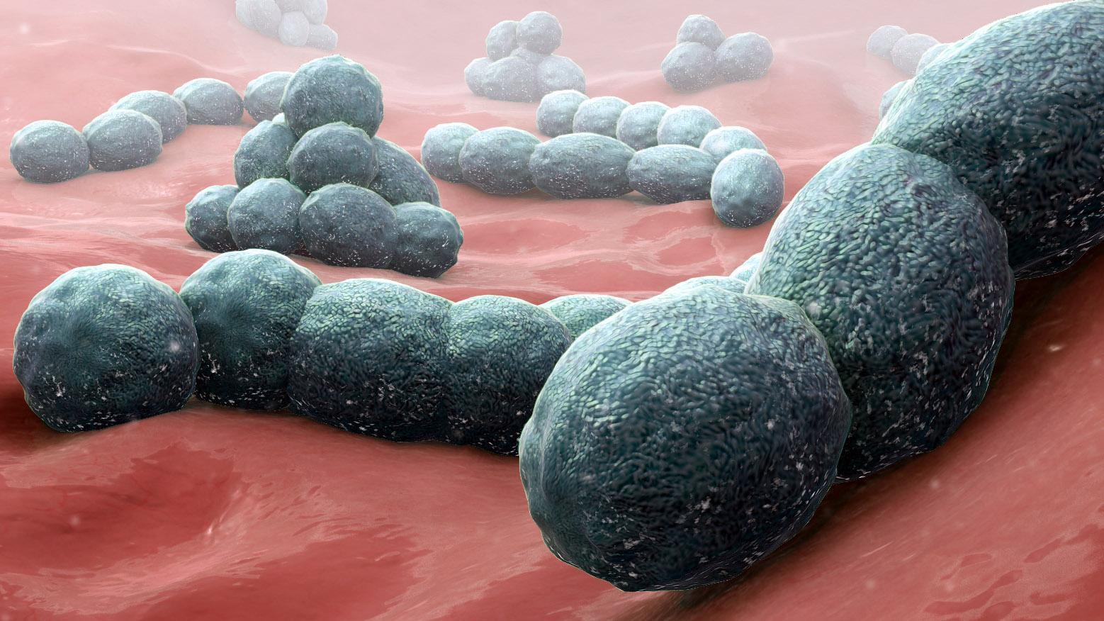 Streptococcus pneumoniae