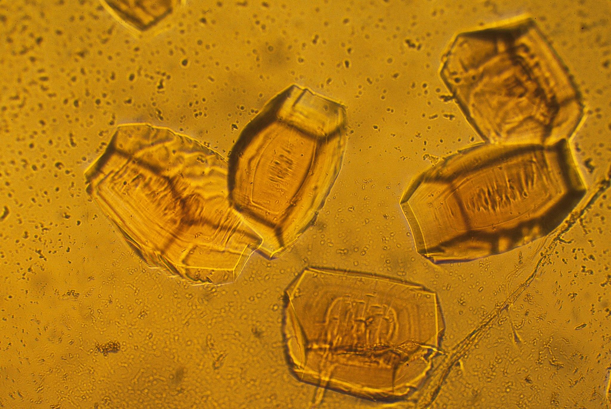 protein crystals