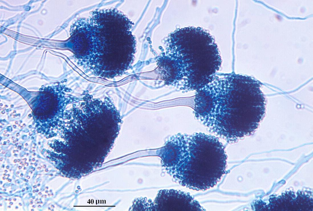 Microscopic image of the common environmental mould Aspergillus fumigatus – harmless to most people but can be deadly if you have a weakened immune system. Dr David Ellis, University of Adelaide