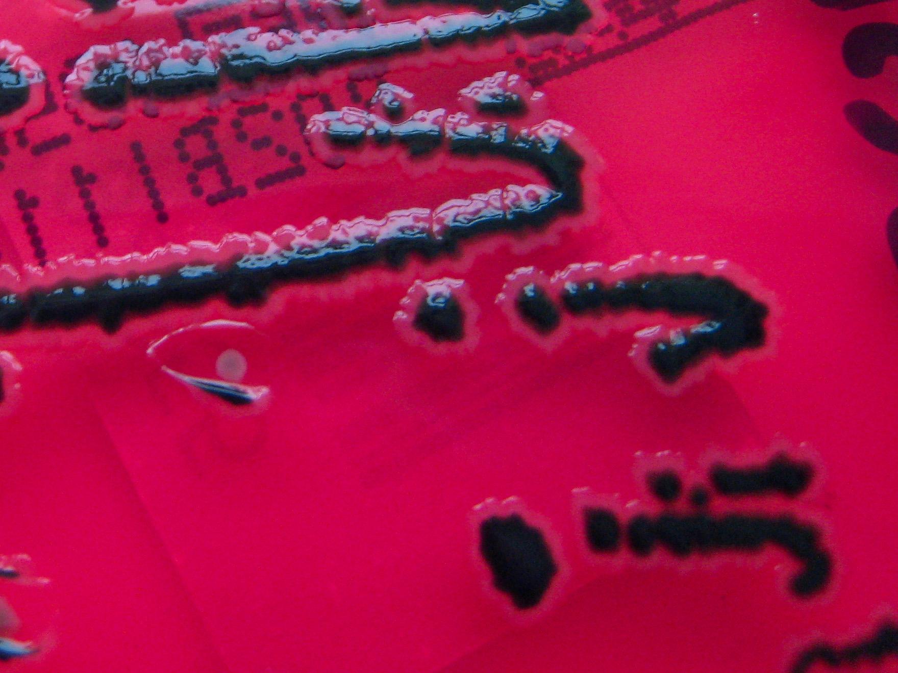 Salmonella species growing on X.L.D. agar Nathan Reading [CC BY-NC-ND 2.0]