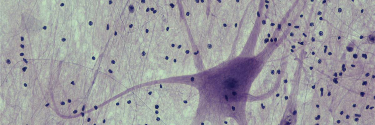 Nervous Tissue: Spinal Cord Motor Neuron | Berkshire Community College Bioscience Image Library (CC0 1.0)