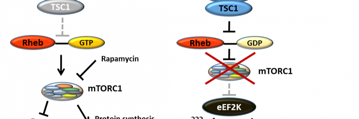 Cancer cells survive and gain the ability to spread under microenvironmental stress conditions through the inhibition of mTORC1 and subsequent activation of eEF2K
