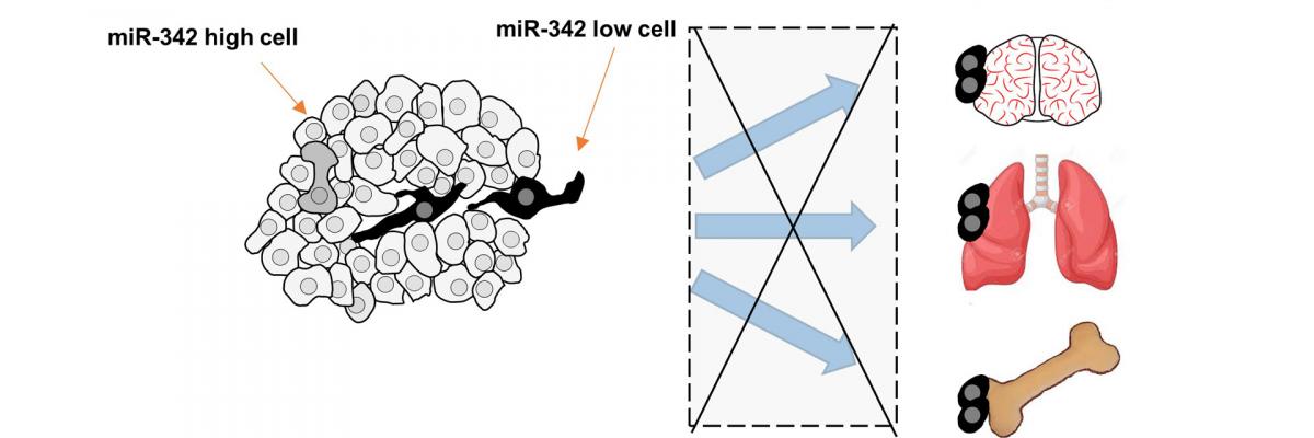 How microRNAs regulate breast cancer metastasis