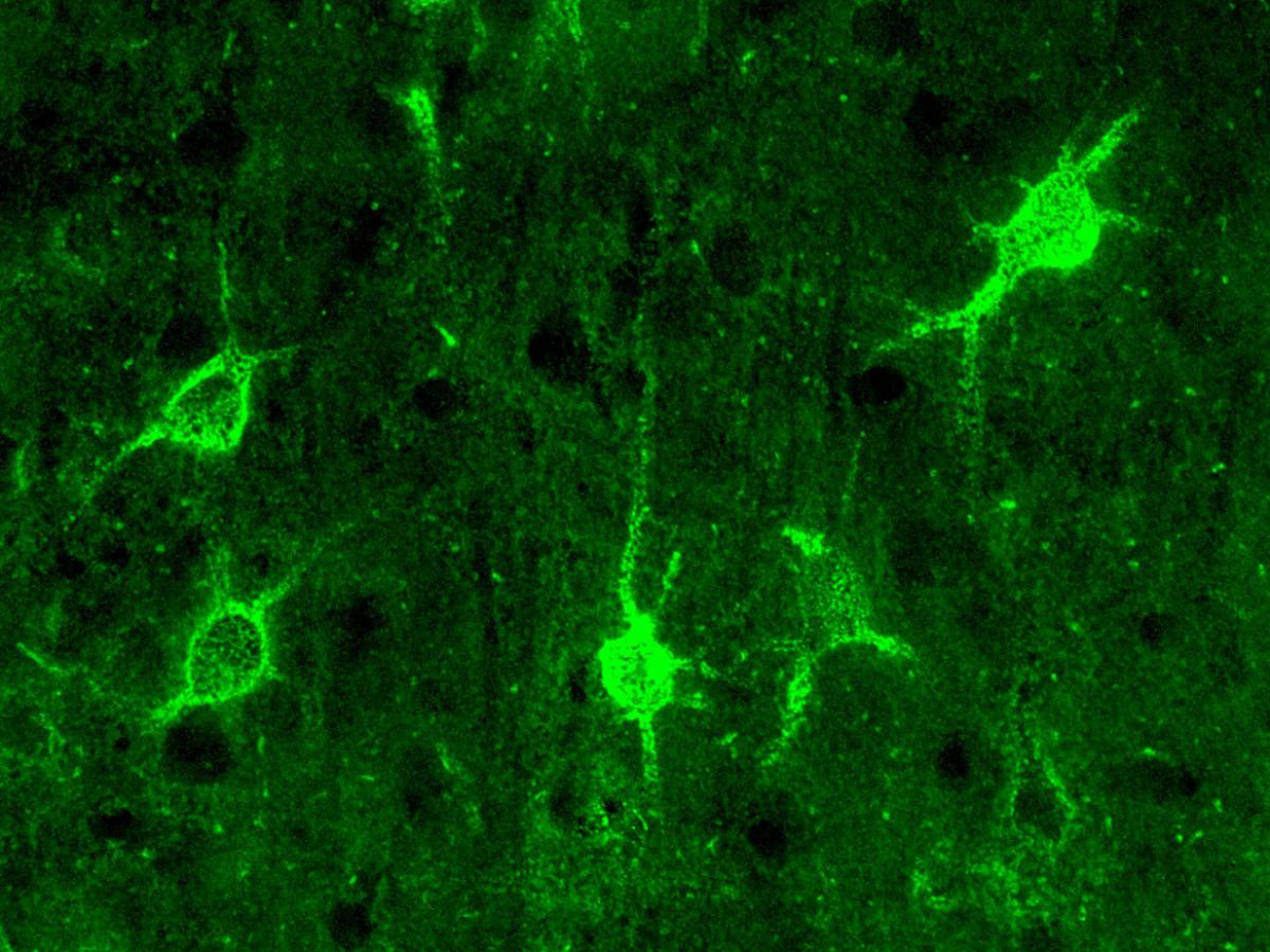 cortex neuronal ecm