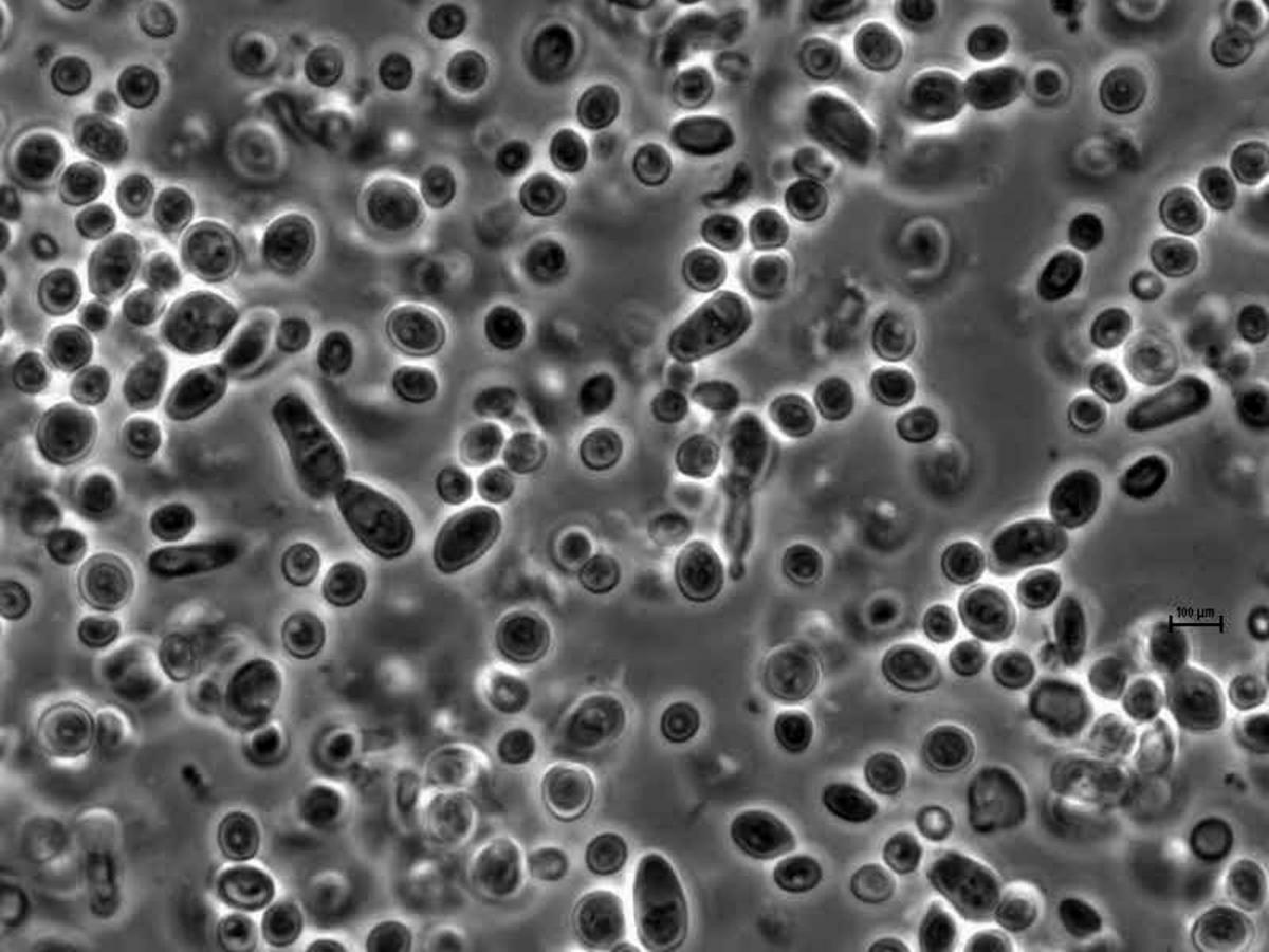 Yeast cells under the microscope 100x
