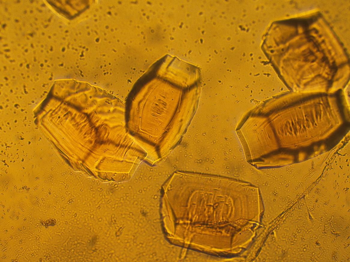 protein crystals