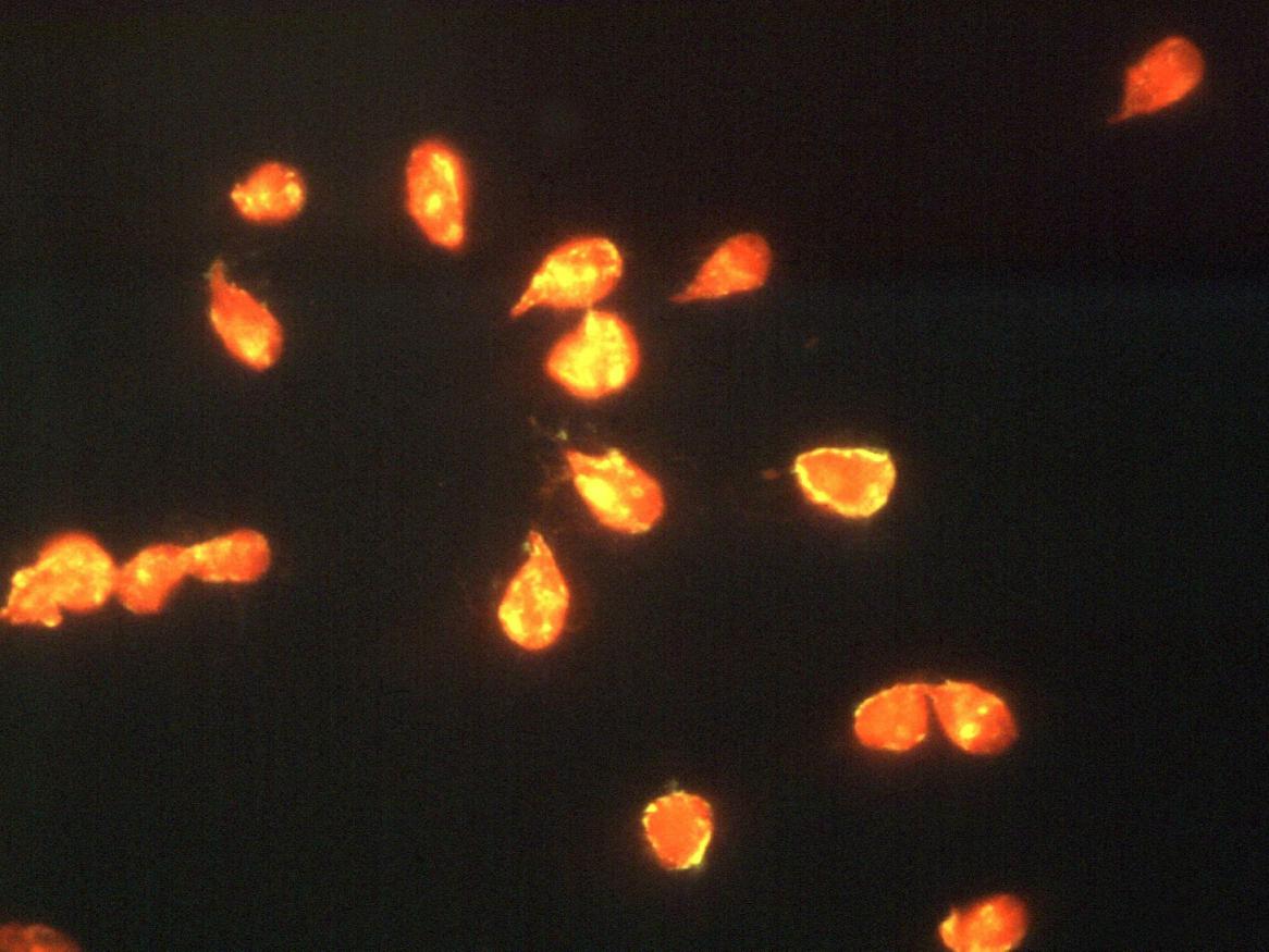 Giardia intestinalis USCDCP [Public domain]