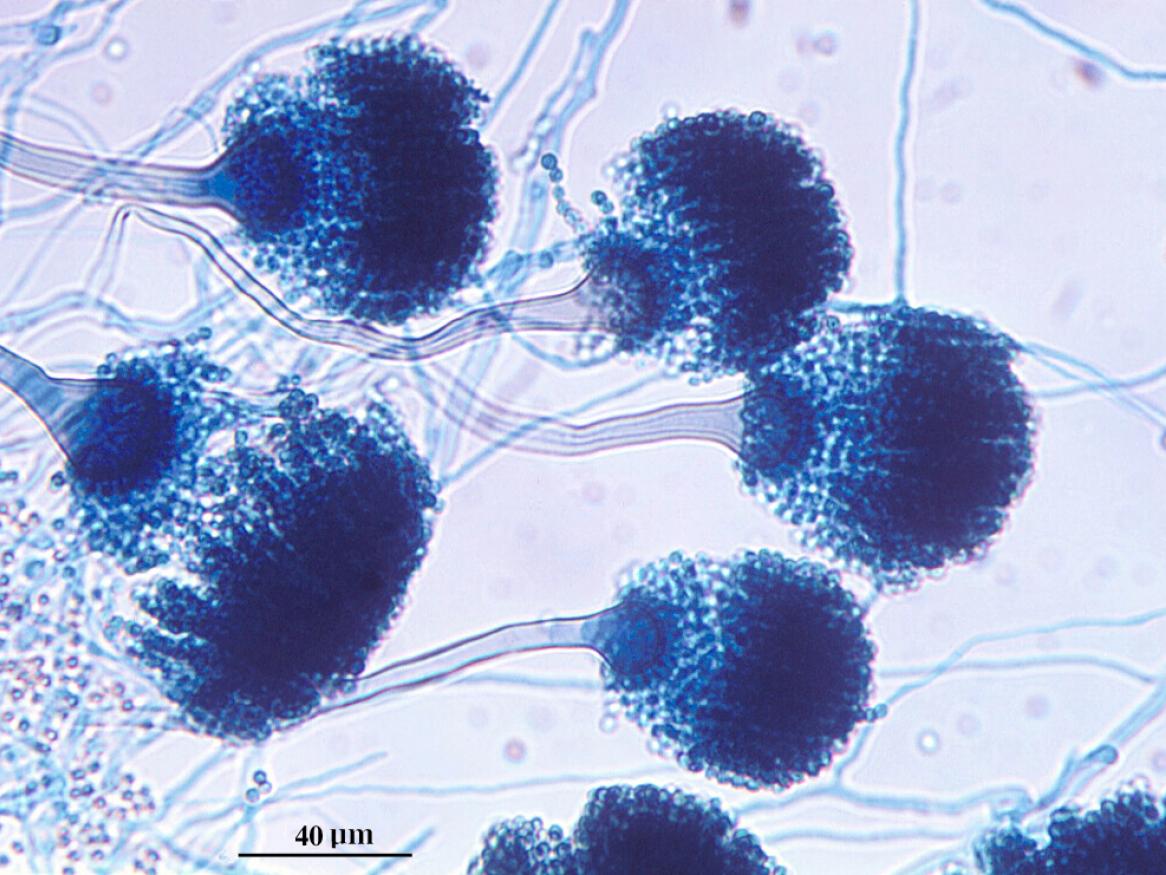 Microscopic image of the common environmental mould Aspergillus fumigatus – harmless to most people but can be deadly if you have a weakened immune system. Dr David Ellis, University of Adelaide