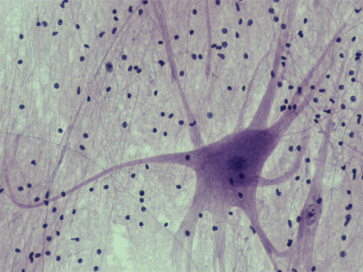 Nervous Tissue: Spinal Cord Motor Neuron | Berkshire Community College Bioscience Image Library (CC0 1.0)