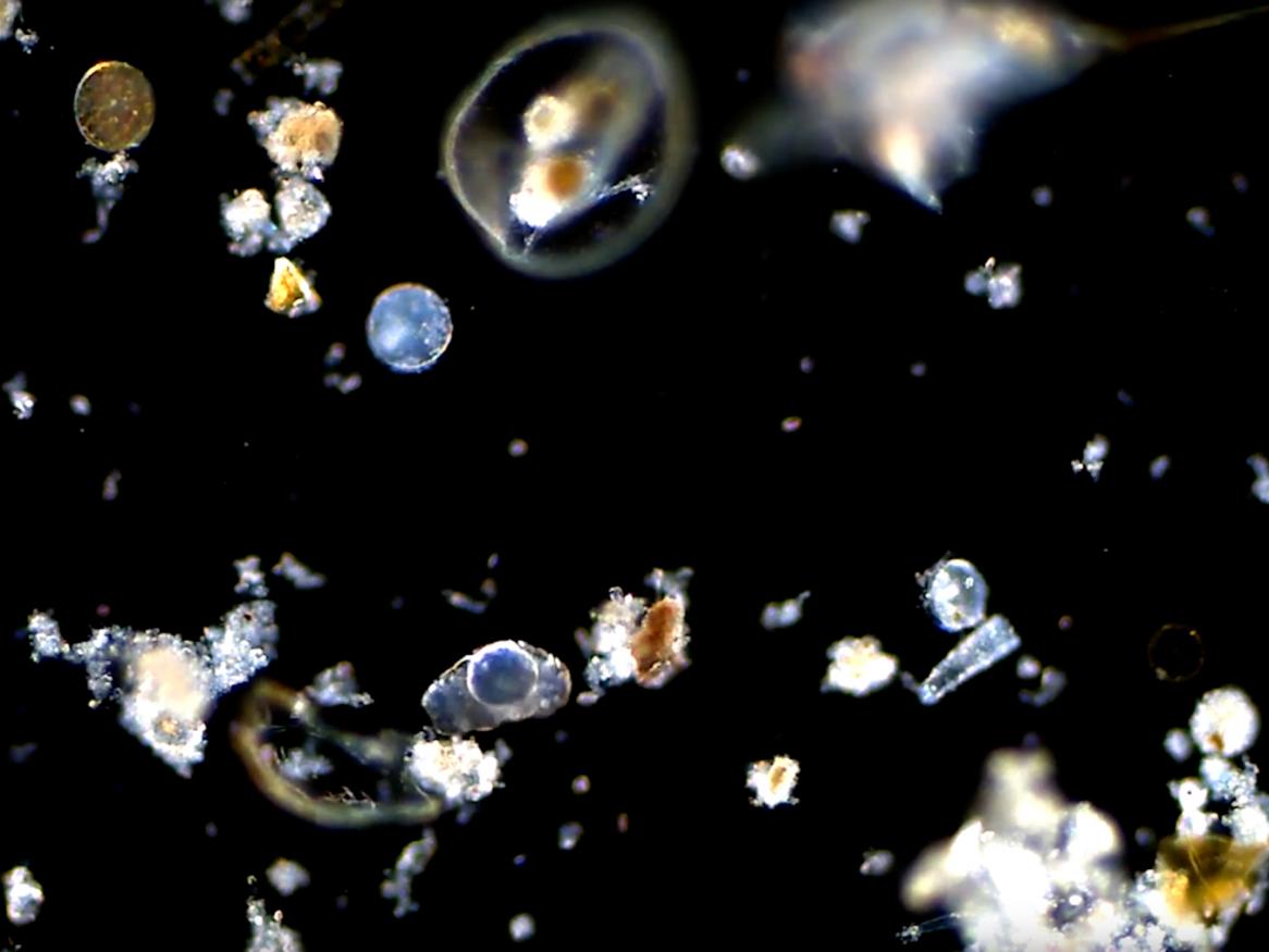 Linda Armbrecht microscope image