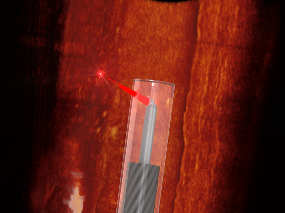 Ultrathin 3D printed endoscope imaging an artery - photo by Simon Thiele and Jiawen Li.