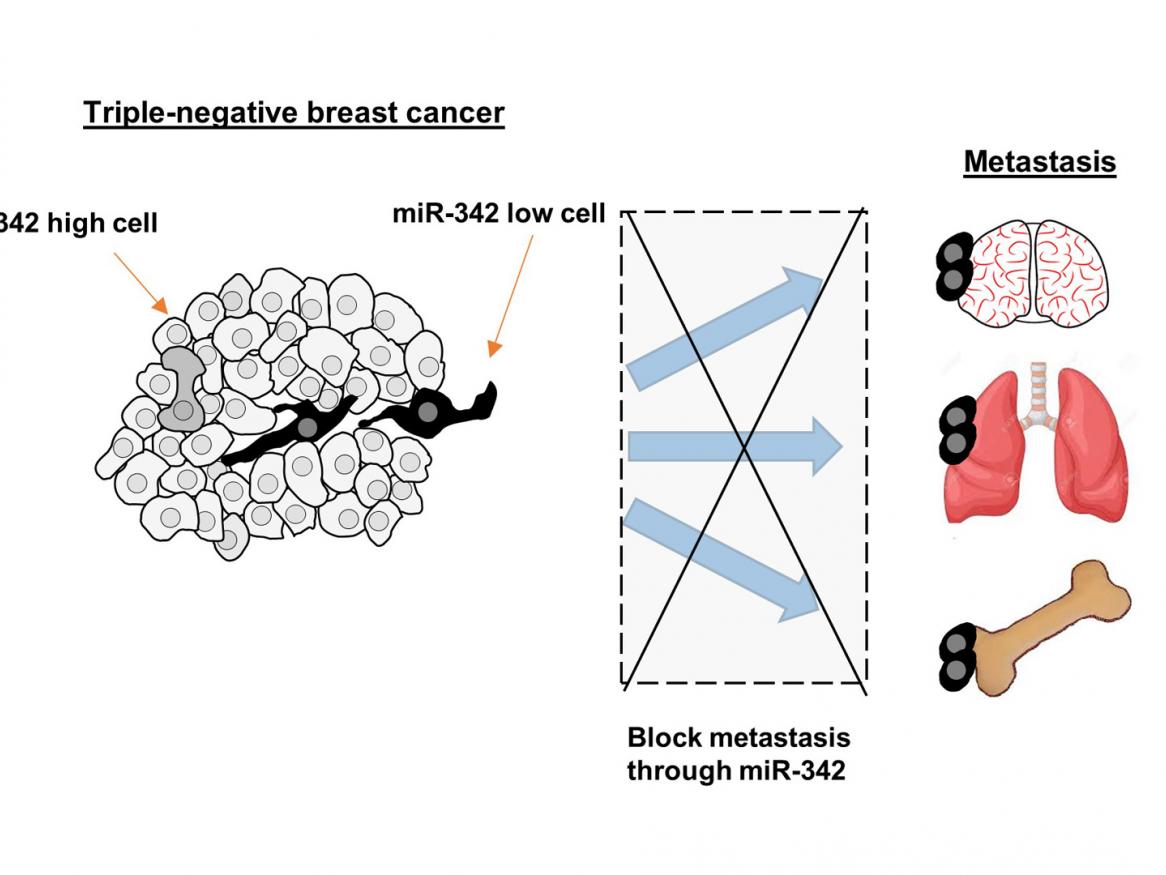 How microRNAs regulate breast cancer metastasis